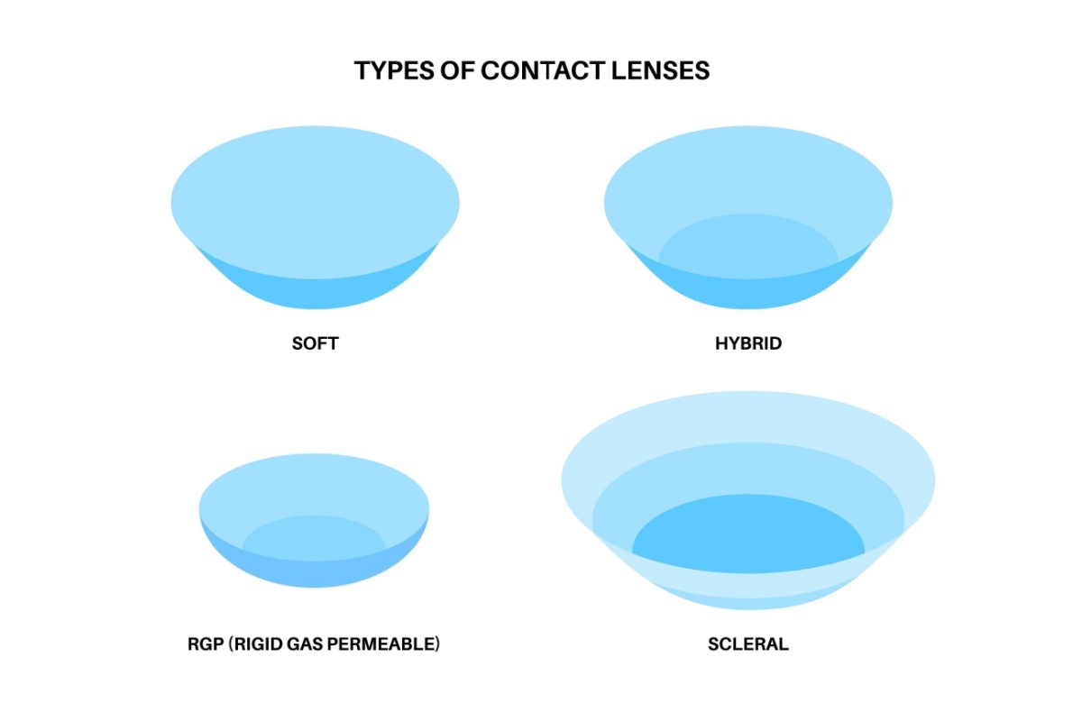 Diagram showing four types of contact lenses: soft, hybrid, RGP (rigid gas permeable), and scleral, illustrated as blue cross-sectional views showing their different structural designs.
